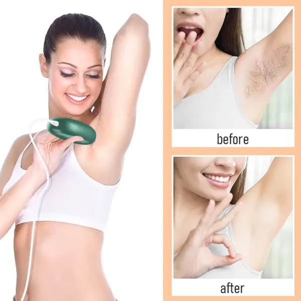 Factory Wholesale IPL Hair Removal Device 999999 Ipl Laser Hair Removal Epilator Home Use Hair Removal Device